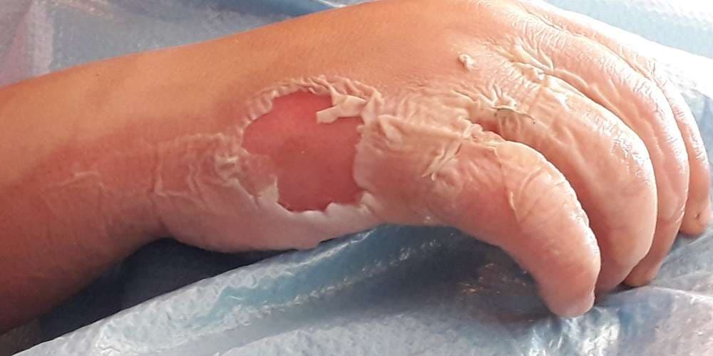 PLANTES TOXIQUES : DES POISONS DANS LE JARDIN