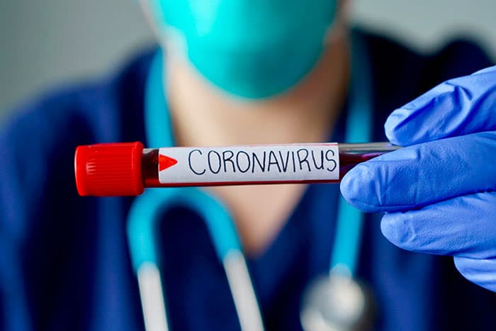 SE FAIRE DEPISTER DU COVID-19 ?